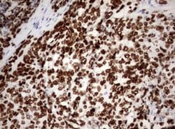 Ki67 Monoclonal Antibody (OTI9H1), TrueMAB , OriGene 100 &mu;L; Unconjugated:Antibodies,