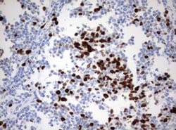 Ki67 Monoclonal Antibody (OTI9H1), TrueMAB , OriGene 100 &mu;L; Unconjugated:Antibodies,