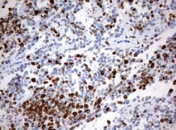 Ki67 Monoclonal Antibody (OTI8B11), TrueMAB , OriGene 100 &mu;L; Unconjugated:Antibodies,