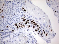 Ki67 Monoclonal Antibody (OTI13F12), TrueMAB , OriGene 100 &mu;L; Unconjugated:Antibodies,