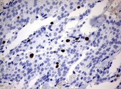 Ki67 Monoclonal Antibody (OTI13F12), TrueMAB , OriGene 100 &mu;L; Unconjugated:Antibodies,