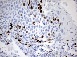 Ki67 Monoclonal Antibody (OTI14G1), TrueMAB , OriGene 100 &mu;L; Unconjugated:Antibodies,