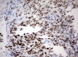 Ki67 Monoclonal Antibody (OTI14G1), TrueMAB , OriGene 100 &mu;L; Unconjugated:Antibodies,