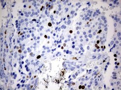Ki67 Monoclonal Antibody (OTI14G1), TrueMAB , OriGene 100 &mu;L; Unconjugated:Antibodies,