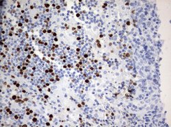 Ki67 Monoclonal Antibody (OTI14G1), TrueMAB , OriGene 100 &mu;L; Unconjugated:Antibodies,