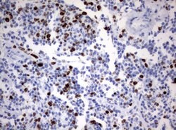 Ki67 Monoclonal Antibody (OTI14G1), TrueMAB , OriGene 100 &mu;L; Unconjugated:Antibodies,