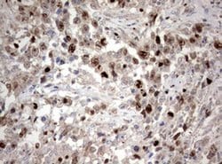 Ki67 Monoclonal Antibody (OTI16E9), TrueMAB , OriGene 100 &mu;L; Unconjugated:Antibodies,