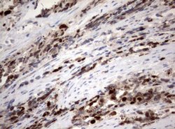 Ki67 Monoclonal Antibody (OTI16E9), TrueMAB , OriGene:Antibodies:Primary
