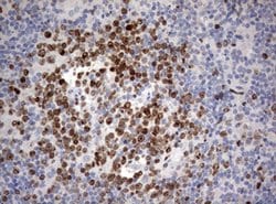 Ki67 Monoclonal Antibody (OTI16E9), TrueMAB , OriGene:Antibodies:Primary