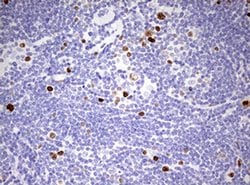 Ki67 Monoclonal Antibody (OTI18G5), TrueMAB , OriGene 100 &mu;L; Unconjugated:Antibodies,