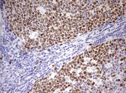 Ki67 Monoclonal Antibody (OTI18G5), TrueMAB , OriGene 100 &mu;L; Unconjugated:Antibodies,