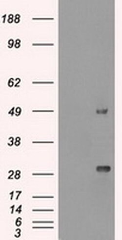 Ki67 Mouse anti-Human, Clone: OTI3D11, liquid, TrueMAB 100 &mu;L; Unconjugated:Antibodies,