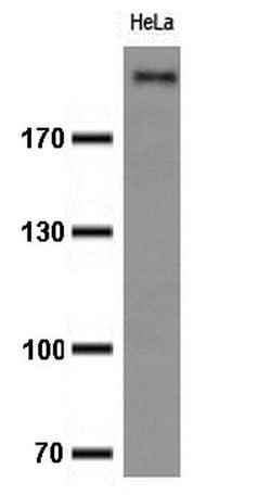 Ki67 Monoclonal Antibody (OTI8H5), TrueMAB , OriGene:Antibodies:Primary