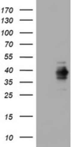 Ki67 Mouse anti-Human, Clone: OTI2B4, lyophilized, TrueMAB 100 &mu;g | Buy Online | Origene Technologies | Fisher Scientific