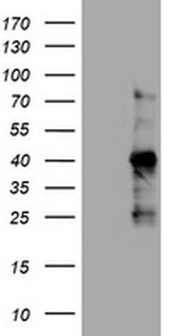Ki67 Monoclonal Antibody (OTI9F12), TrueMAB , OriGene:Antibodies:Primary