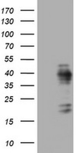 Ki67 Monoclonal Antibody (OTI9C3), TrueMAB , OriGene 100 &mu;L; Unconjugated:Antibodies,