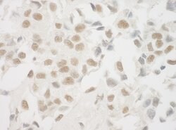 Ku70 Polyclonal Antibody, Bethyl Laboratories 100 &mu;L; Unconjugated:Antibodies,
