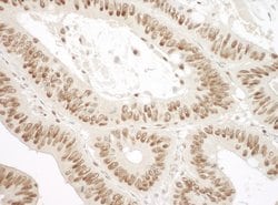 Ku70 Polyclonal Antibody, Bethyl Laboratories:Antibodies:Primary Antibodies