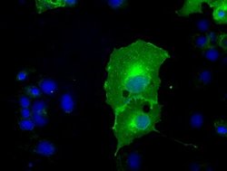 L1CAM Mouse anti-Human, Clone: OTI2C7, lyophilized, TrueMAB 100 &mu;g;