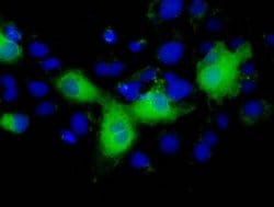 L1CAM Mouse anti-Human, Clone: OTI2H5, liquid, TrueMAB 100 &mu;L; Unconjugated:Antibodies,
