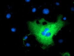 L1CAM Mouse anti-Canine, Human, Clone: OTI2G9, lyophilized, TrueMAB 100