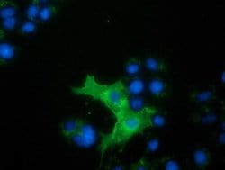 L1CAM Mouse anti-Human, Clone: OTI2G5, lyophilized, TrueMAB 100 &mu;g;