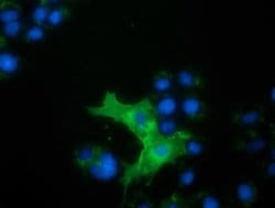 L1CAM Monoclonal Antibody (OTI2G5), TrueMAB , OriGene 100 &mu;L; Unconjugated:Antibodies,