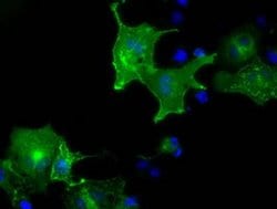 L1CAM Monoclonal Antibody (OTI2H4), TrueMAB , OriGene:Antibodies:Primary