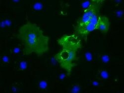 L1CAM Mouse anti-Human, Clone: OTI2B11, lyophilized, TrueMAB 100 &mu;g;
