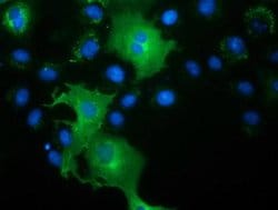 L1CAM Monoclonal Antibody (OTI2H6), TrueMAB , OriGene 30 &mu;L; Unconjugated:Antibodies,