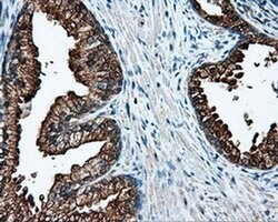 L1CAM Mouse anti-Human, Clone: OTI2H5, liquid, TrueMAB 100 &mu;L; Unconjugated:Antibodies,