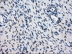 L1CAM Mouse anti-Human, Clone: OTI4F4, lyophilized, TrueMAB 100 &mu;g;