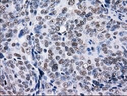 L1CAM Mouse anti-Human, Clone: OTI4F4, lyophilized, TrueMAB 100 &mu;g;
