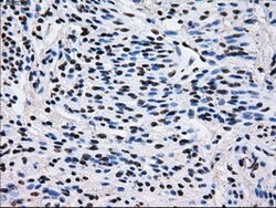 L1CAM Mouse anti-Human, Clone: OTI4F4, lyophilized, TrueMAB 100 &mu;g;