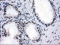 L1CAM Mouse anti-Human, Clone: OTI4F4, lyophilized, TrueMAB 100 &mu;g;
