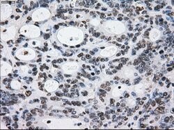 L1CAM Mouse anti-Human, Clone: OTI4F4, lyophilized, TrueMAB 100 &mu;g;