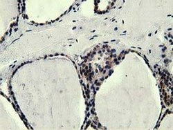 L1CAM Monoclonal Antibody (OTI2H6), TrueMAB , OriGene 30 &mu;L; Unconjugated:Antibodies,