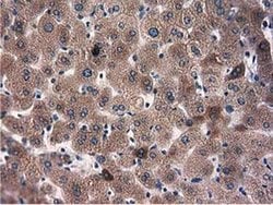 L1CAM Monoclonal Antibody (OTI2H6), TrueMAB , OriGene 30 &mu;L; Unconjugated:Antibodies,