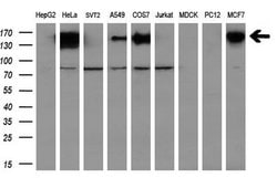 L1CAM Mouse anti-Human, Clone: OTI2C7, lyophilized, TrueMAB 100 &mu;g;