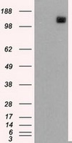 L1CAM Mouse anti-Human, Clone: OTI2H5, liquid, TrueMAB 100 &mu;L; Unconjugated:Antibodies,