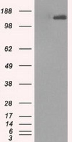 L1CAM Mouse anti-Human, Clone: OTI4F4, lyophilized, TrueMAB 100 &mu;g;