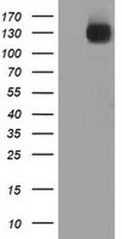 L1CAM Monoclonal Antibody (OTI1A8), TrueMAB , OriGene 30 &mu;L; Unconjugated:Antibodies,