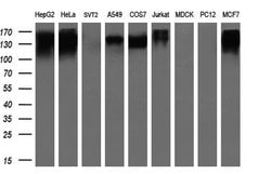 L1CAM Monoclonal Antibody (OTI1A8), TrueMAB , OriGene:Antibodies:Primary
