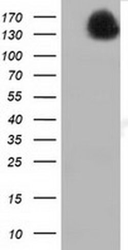 L1CAM Monoclonal Antibody (OTI2A5), TrueMAB , OriGene 30 &mu;L; Unconjugated:Antibodies,