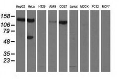 L1CAM Monoclonal Antibody (OTI2A5), TrueMAB , OriGene 30 &mu;L; Unconjugated:Antibodies,