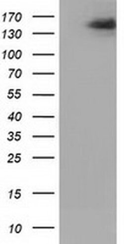 L1CAM Monoclonal Antibody (OTI1D12), TrueMAB , OriGene 30 &mu;L; Unconjugated:Antibodies,