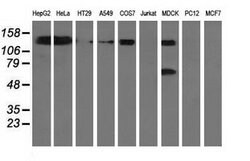 L1CAM Mouse anti-Canine, Human, Clone: OTI2G9, lyophilized, TrueMAB 100