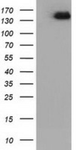 L1CAM Mouse anti-Human, Clone: OTI2G5, lyophilized, TrueMAB 100 &mu;g;