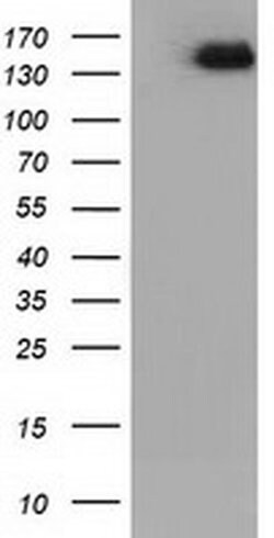 L1CAM Monoclonal Antibody (OTI2G5), TrueMAB , OriGene 100 &mu;L; Unconjugated:Antibodies,