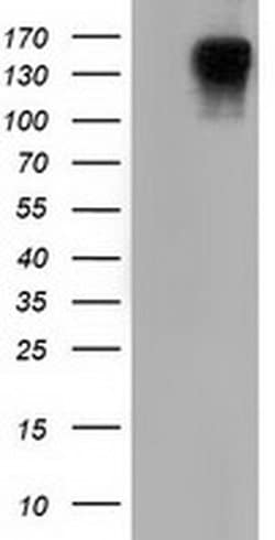 L1CAM Monoclonal Antibody (OTI2H6), TrueMAB , OriGene:Antibodies:Primary